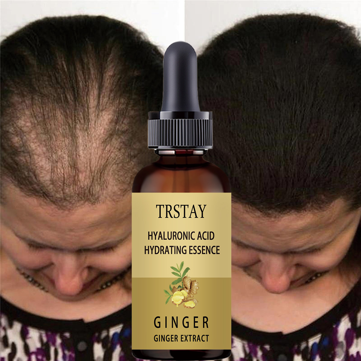 Hair Care Gisou - Serum Anti pencegah rambut rontok, cairan