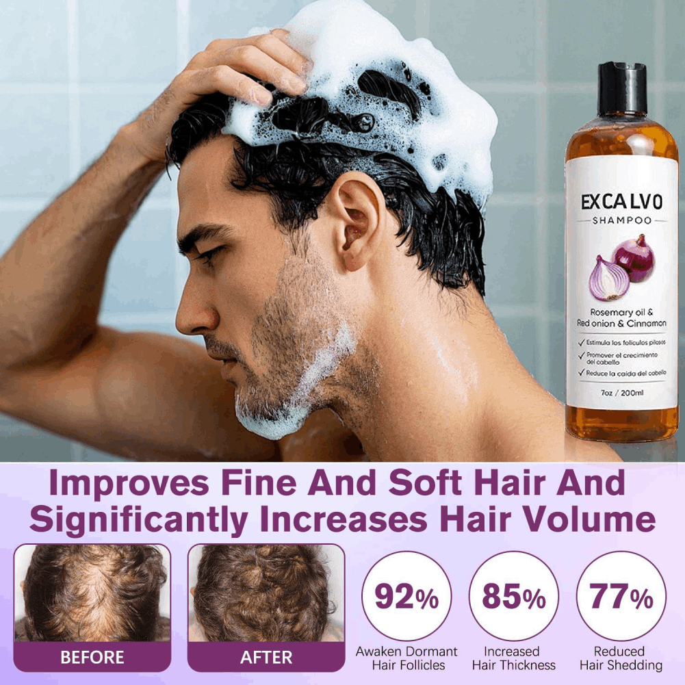 200ml Sampo Anti Rambut Rontok - Rosemary Hair Oil ulasan dan harga