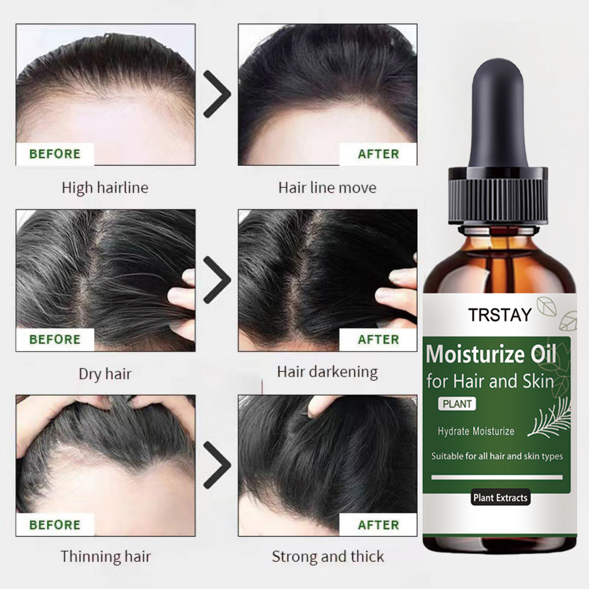TRSTAY Minyak Esensial Rosemar - Rosemary Hair Oil ulasan dan harga