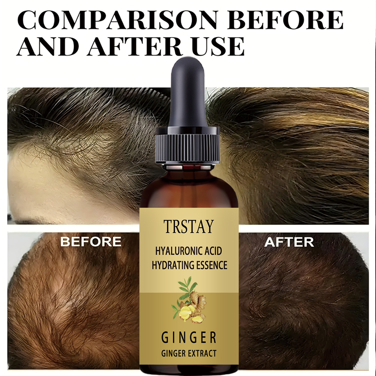 Serum Anti pencegah rambut ron - Hair Care Gisou ulasan dan harga