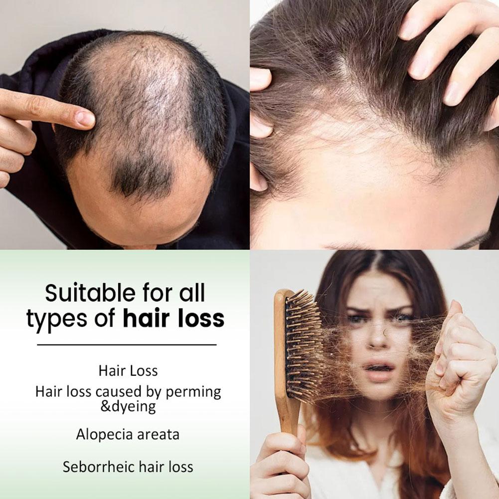 1/2 Buah Sampo Rambut Rosemary - Rosemary Hair Oil ulasan dan harga