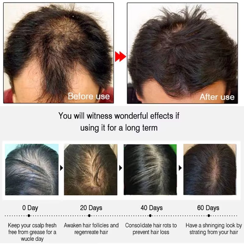 Semprotan Penumbuh Rambut Jahe - Hair Care Naturally ulasan dan harga